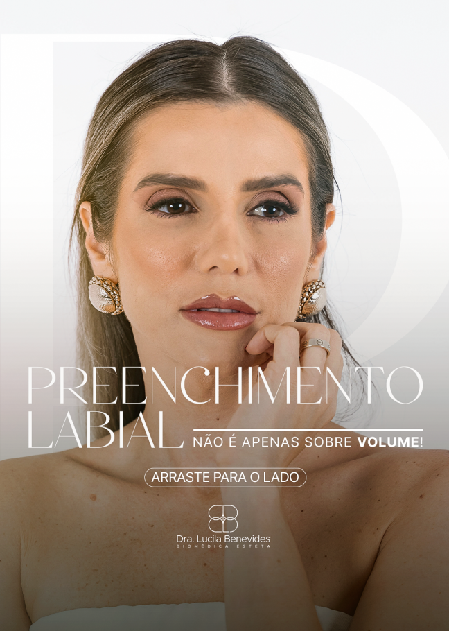 CARROSSEL-PRENCHIMENTO-LABIAL_01
